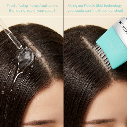 PDRN Reedle Shot Hair Serum
